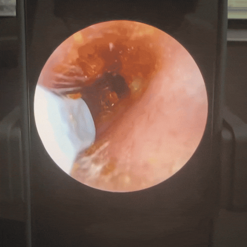 Sanvero VisioEar: zatwierdzona przez lekarzy technologia dbająca o zdrowie uszu